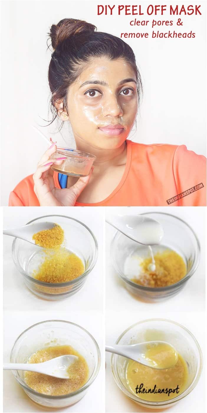 13 Safe Homemade Blackhead Remedies That Work