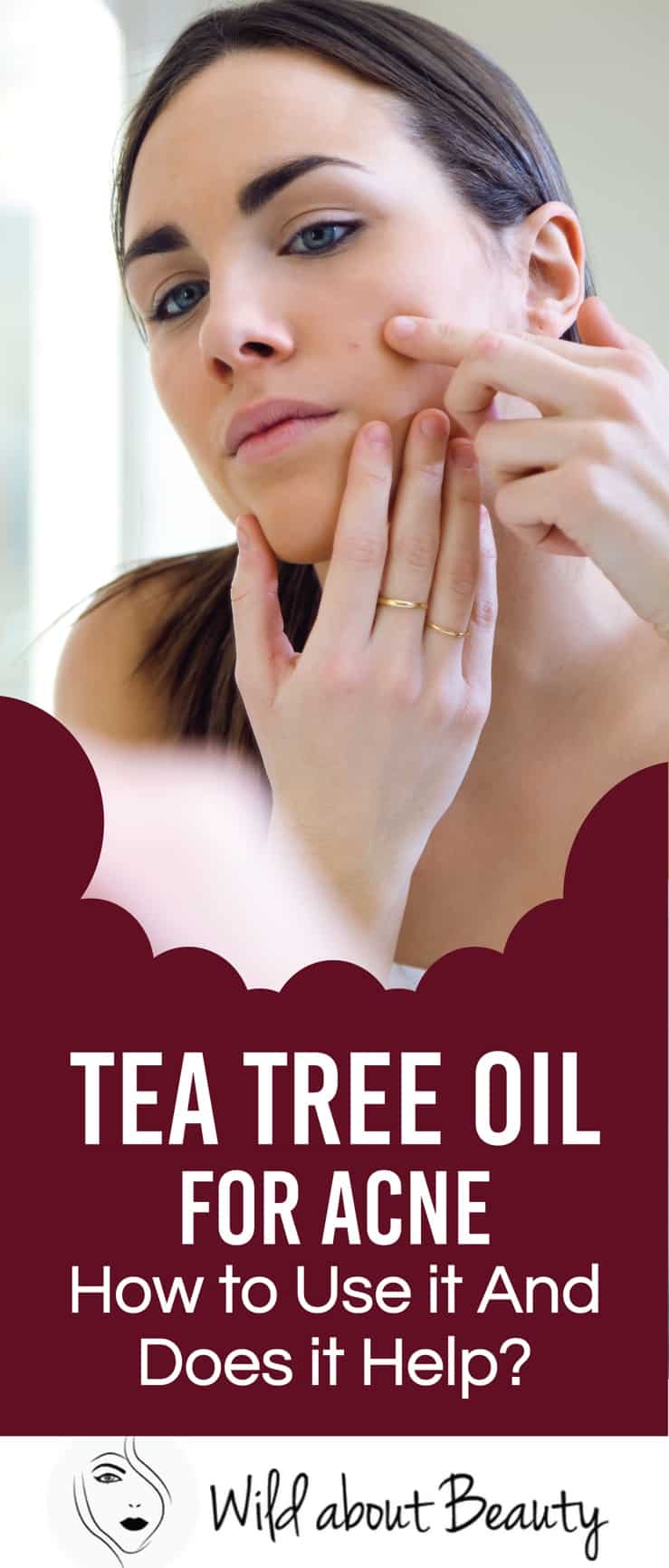 Tea tree oil for acne
