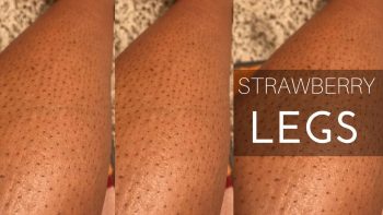Strawberry Legs