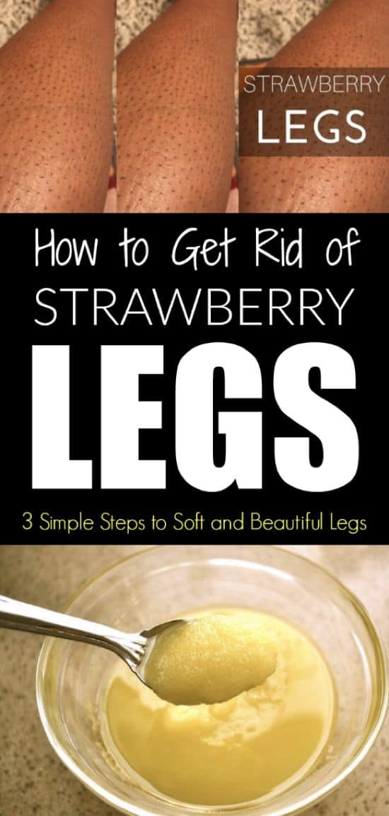 How To Get Rid Of Strawberry Legs 3 Simple Steps To Soft And Beautiful Legs 