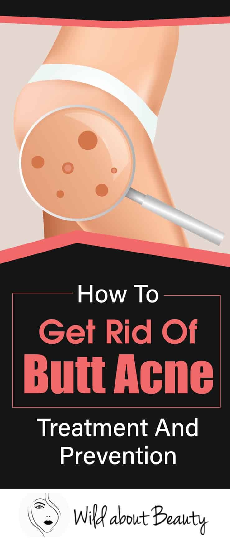 How To Get Rid Of Butt Acne