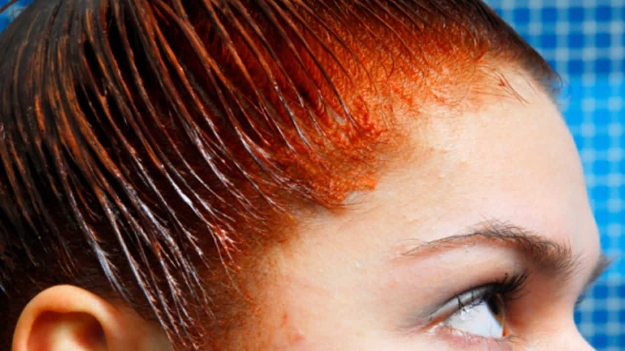 How to Remove Hair Dye From Skin