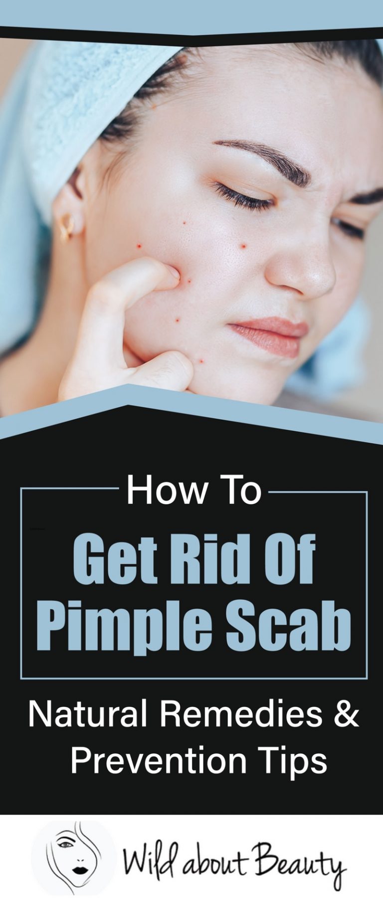 how-to-get-rid-of-pimple-scabs-natural-remedies-and-prevention-tips