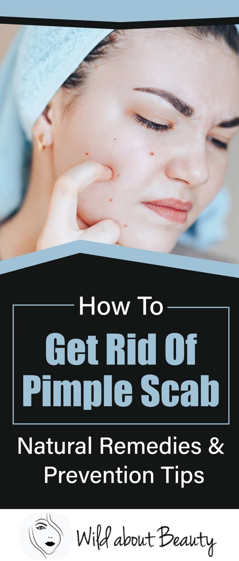 How To Get Rid Of Pimple Scabs