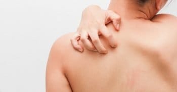 skin infections