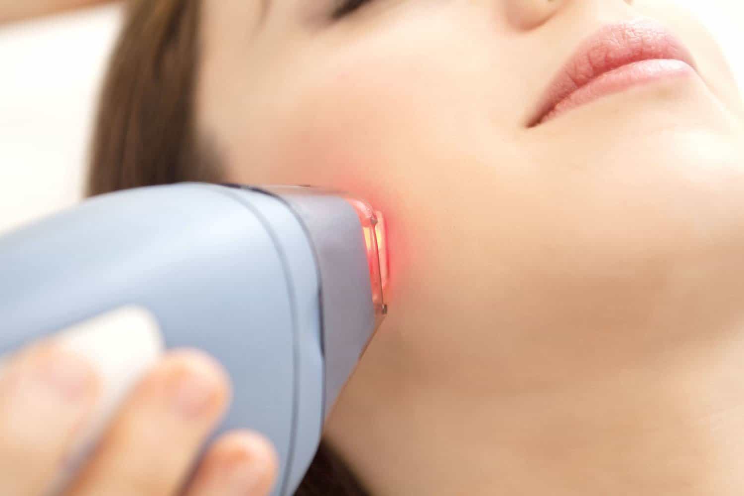 Laser hair removal