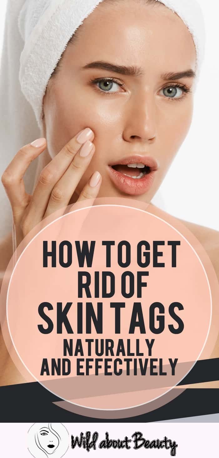 How to get rid of skin tags