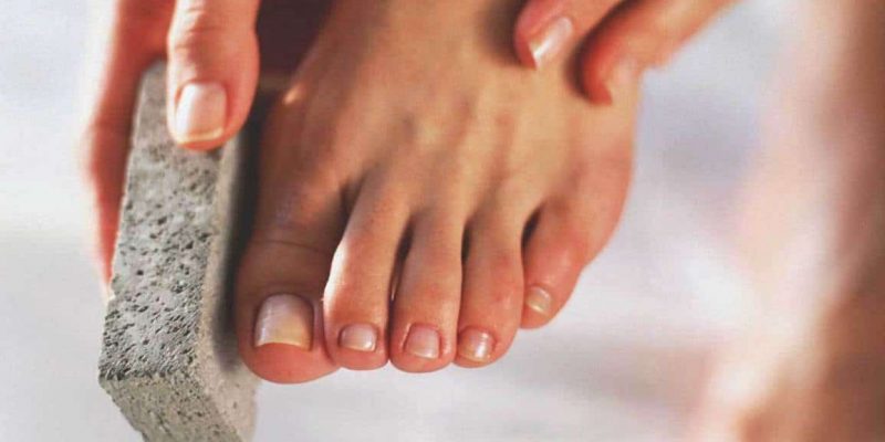 best treatment for dead skin on feet