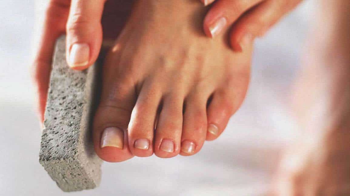 how-to-get-rid-of-dead-skin-on-feet-best-treatments