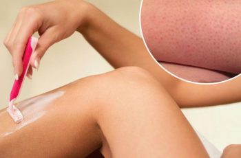 How To Get Rid Of Razor Bumps Overnight
