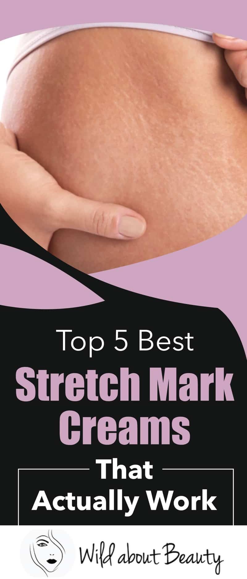 Top 5 Best Stretch Mark Creams