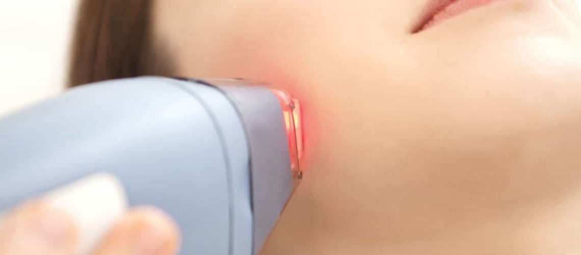 Laser hair removal