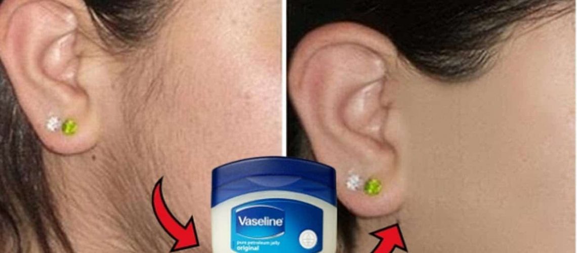This Vaseline Trick Can Help You Remove Unwanted Hair